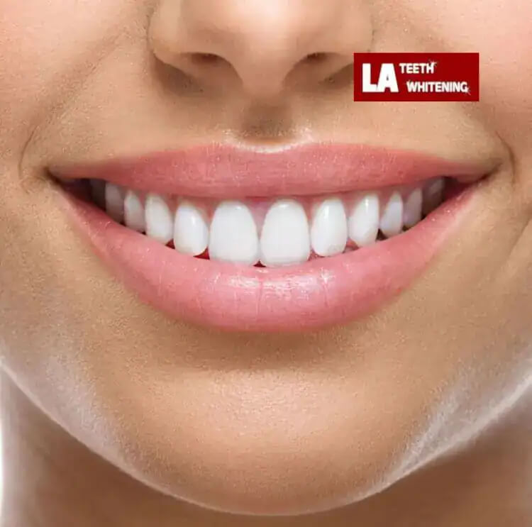 https://www.google.com/url?sa=i&url=https%3A%2F%2Fwww.charmdentalcare.com%2Fcosmetic-teeth-whitening%2F&psig=AOvVaw11xAEuQUiY2yVJ2lA49roa&ust=1756453621698000&source=images&cd=vfe&opi=89978449&ved=0CBUQjRxqFwoTCJifk-SBrY8DFQAAAAAdAAAAABAj