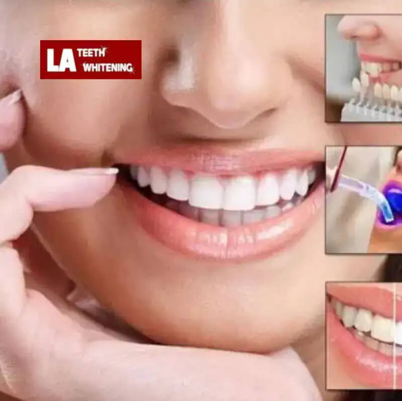 https://www.google.com/url?sa=i&url=https%3A%2F%2Fwww.charmdentalcare.com%2Fcosmetic-teeth-whitening%2F&psig=AOvVaw11xAEuQUiY2yVJ2lA49roa&ust=1756453621698000&source=images&cd=vfe&opi=89978449&ved=0CBUQjRxqFwoTCJifk-SBrY8DFQAAAAAdAAAAABAj